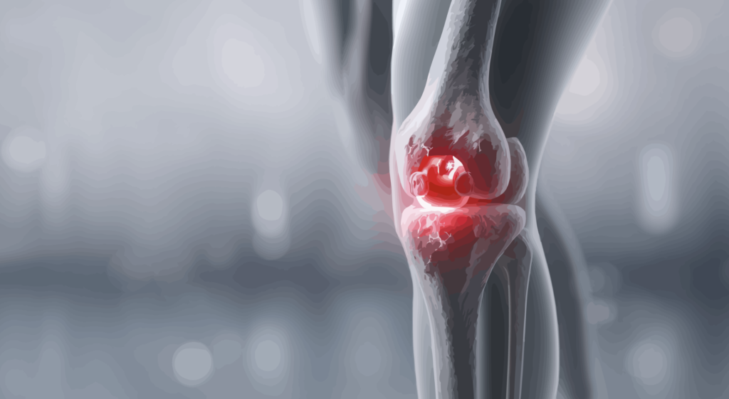 オスグッドは「真実」を突き止めれば5回で改善する。