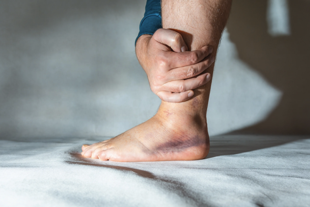 8か月経っても治らなかった捻挫後の痛みが､たった2か月で改善できた理由とは？